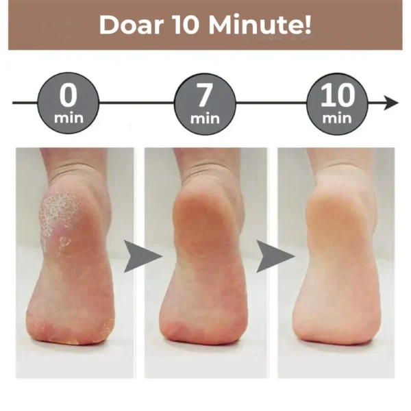 pila electrica 3 Rezultatul utilizarii a pilei electrice portabile